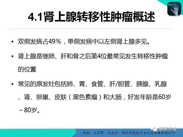 【PPT】肾上腺恶性肿瘤CT诊断