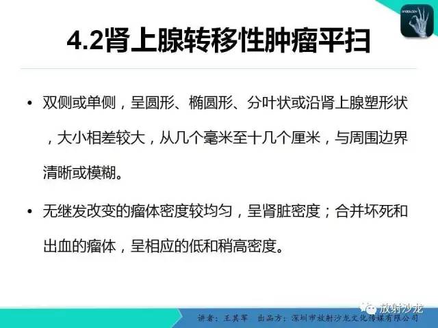 【PPT】肾上腺恶性肿瘤CT诊断