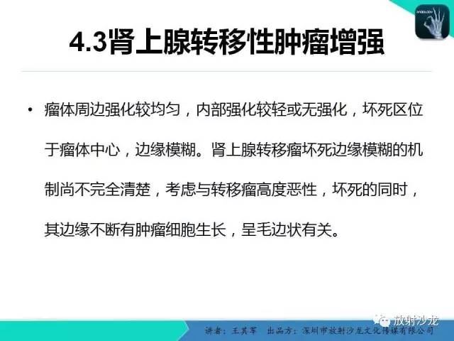【PPT】肾上腺恶性肿瘤CT诊断