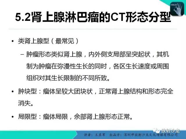【PPT】肾上腺恶性肿瘤CT诊断