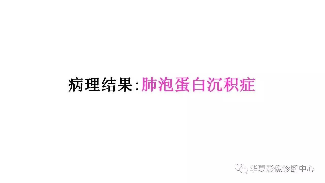 【病例】肺泡蛋白沉积症1例CT影像表现