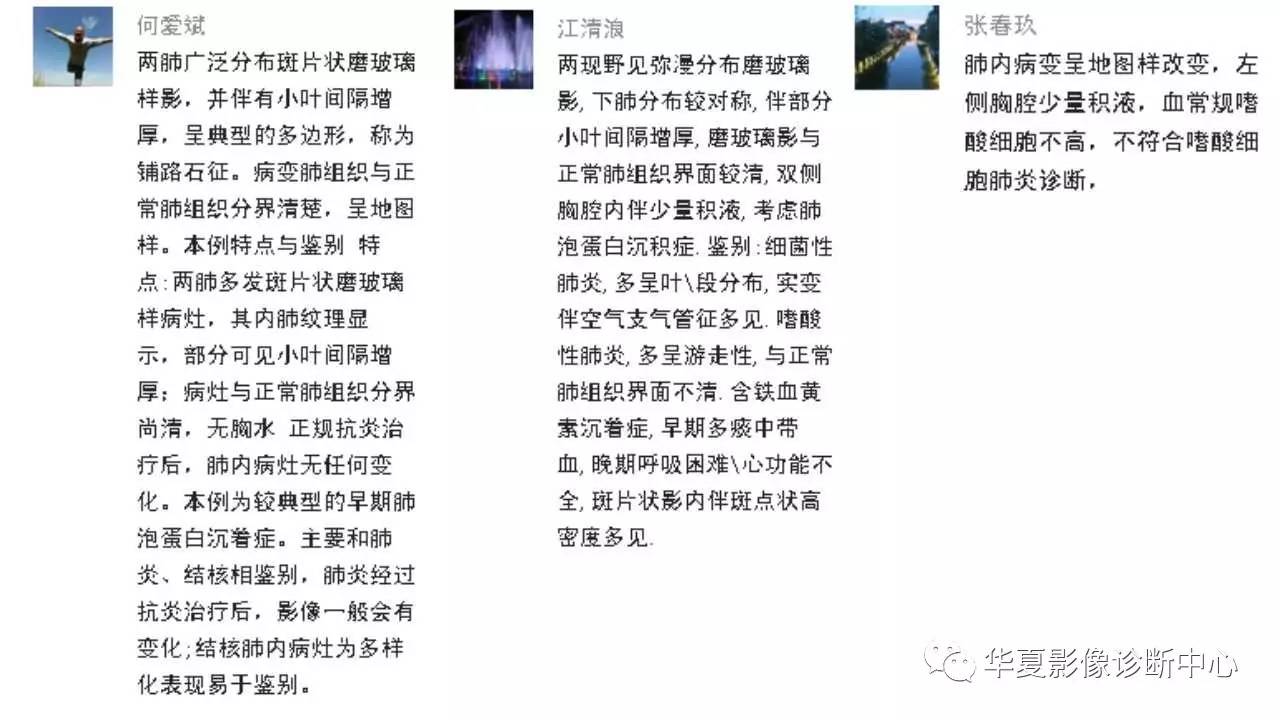 【病例】肺泡蛋白沉积症1例CT影像表现