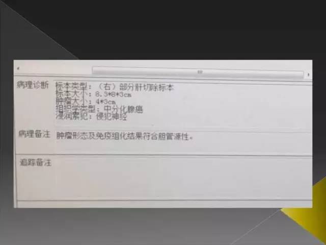 【病例】周围型胆管细胞癌1例CT及MR影像表现 【病例】周围型胆管细胞癌1例CT及MR影像表现
