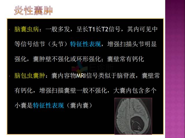 【病例】四脑室内表皮样囊肿1例MR分析思路