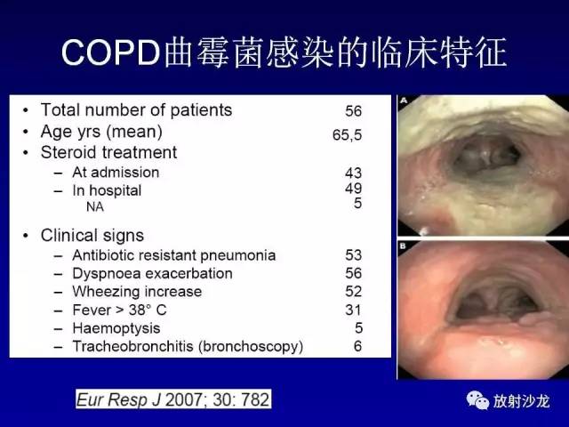 【PPT】肺真菌病的影像诊断与鉴别诊断