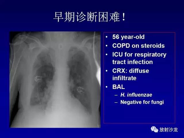 【PPT】肺真菌病的影像诊断与鉴别诊断