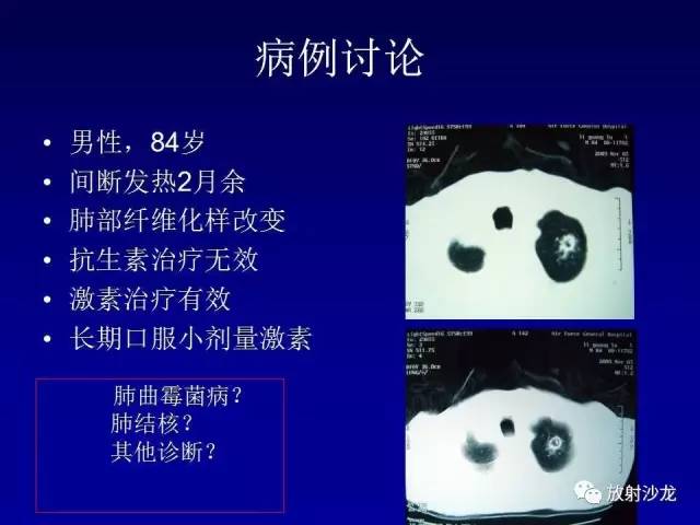 【PPT】肺真菌病的影像诊断与鉴别诊断