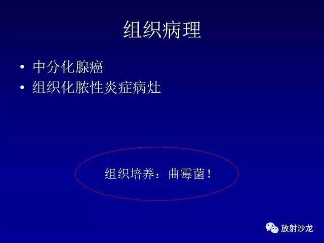 【PPT】肺真菌病的影像诊断与鉴别诊断