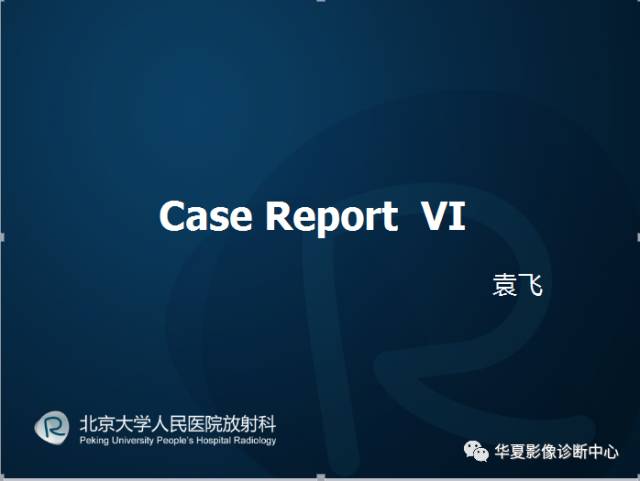 【病例】SAPHO综合征1例CT影像表现