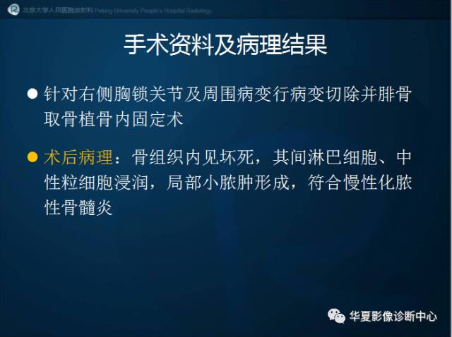【病例】SAPHO综合征1例CT影像表现