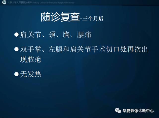【病例】SAPHO综合征1例CT影像表现