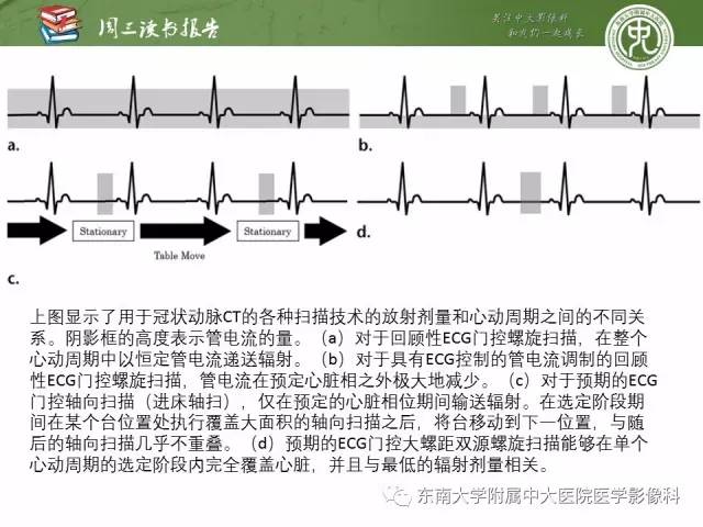 【PPT】冠状动脉CT成像新技术【RG精选】