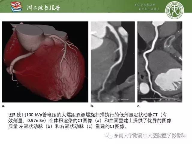 【PPT】冠状动脉CT成像新技术【RG精选】