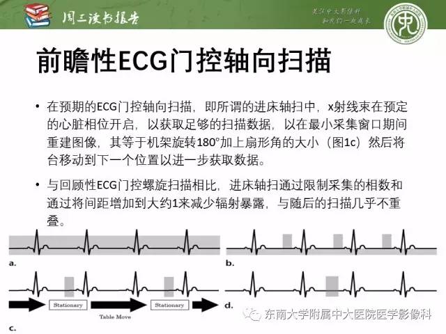 【PPT】冠状动脉CT成像新技术【RG精选】