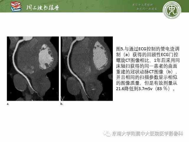 【PPT】冠状动脉CT成像新技术【RG精选】