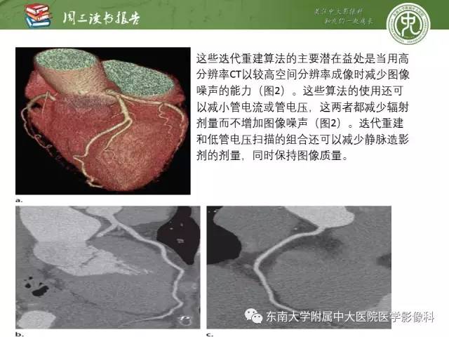 【PPT】冠状动脉CT成像新技术【RG精选】