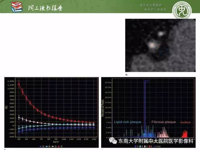 【PPT】冠状动脉CT成像新技术【RG精选】