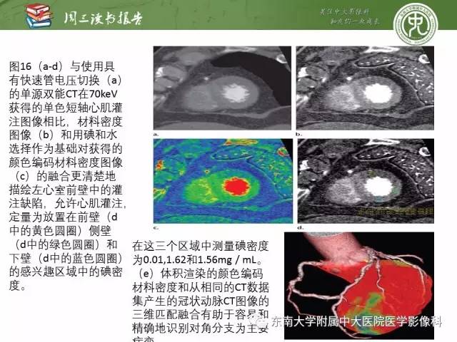 【PPT】冠状动脉CT成像新技术【RG精选】