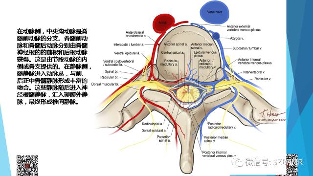 【PPT】脊髓常见血管性病变的临床与影像