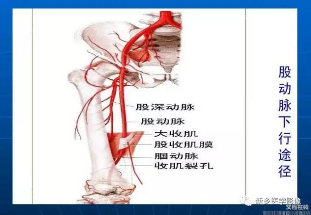 【PPT】下肢动脉解剖