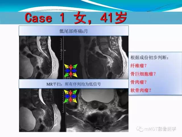 【PPT】骶尾椎病变的诊断思路