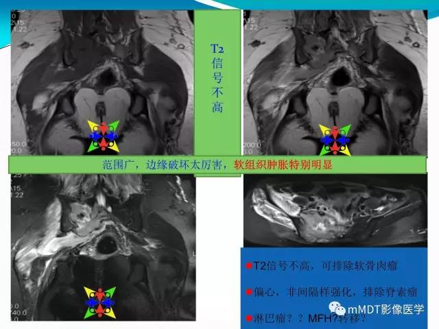 【PPT】骶尾椎病变的诊断思路