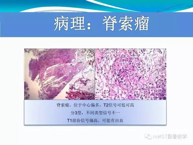 【PPT】骶尾椎病变的诊断思路