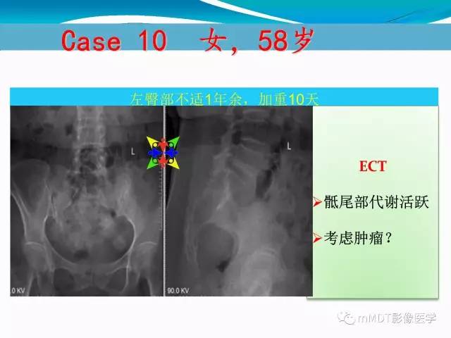 【PPT】骶尾椎病变的诊断思路