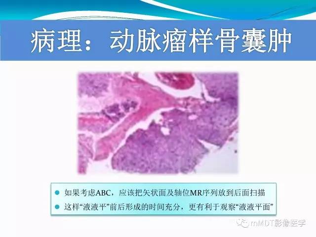【PPT】骶尾椎病变的诊断思路