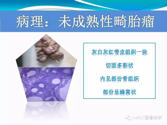 【PPT】骶尾椎病变的诊断思路