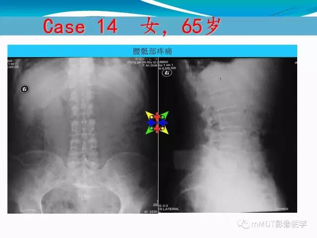 【PPT】骶尾椎病变的诊断思路