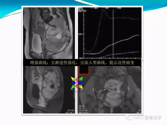 【PPT】骶尾椎病变的诊断思路