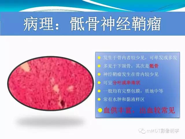 【PPT】骶尾椎病变的诊断思路