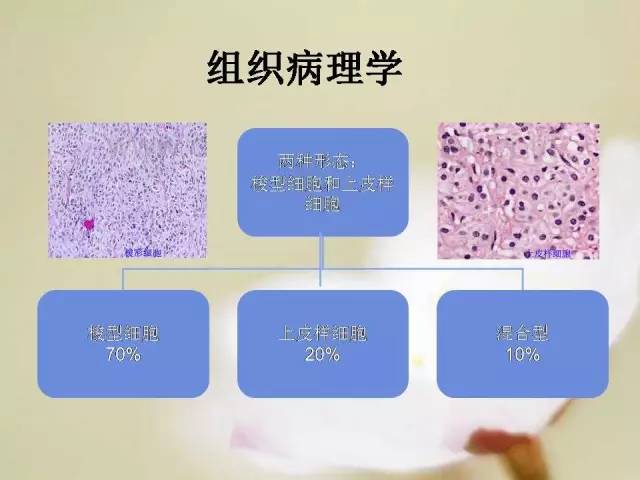 【病例】胃肠道间质瘤1例影像诊断与鉴别 【病例】胃肠道间质瘤1例影像诊断与鉴别