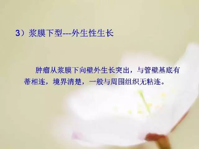 【病例】胃肠道间质瘤1例影像诊断与鉴别 【病例】胃肠道间质瘤1例影像诊断与鉴别