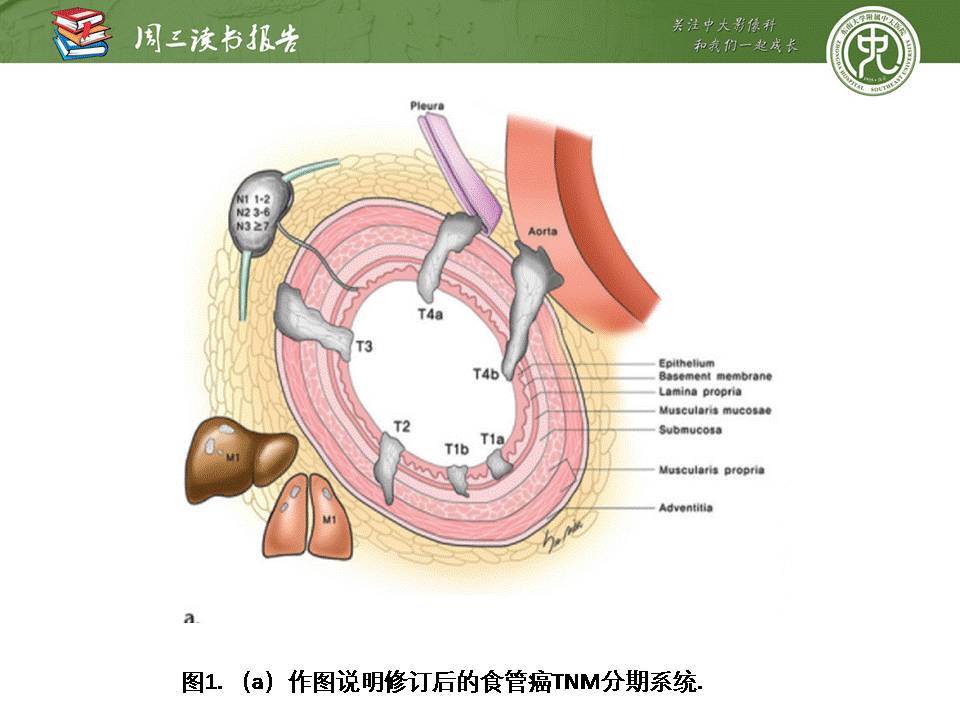 【PPT】食管癌的新TNM分期系统——放射科医生须知