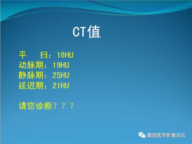 【病例】腹膜后高分化脂肪肉瘤1例CT 【病例】腹膜后高分化脂肪肉瘤1例CT