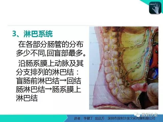 【PPT】回盲部常见病变的MSCT表现