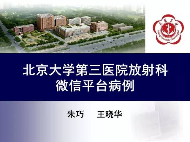 【病例】特发性间质性肺炎2例CT影像表现