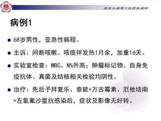 【病例】特发性间质性肺炎2例CT影像表现