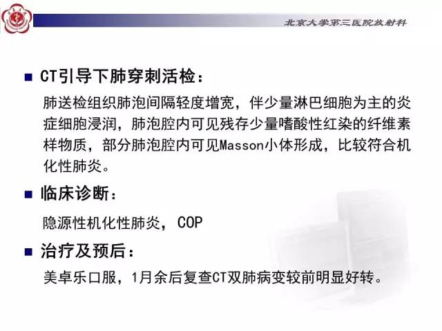 【病例】特发性间质性肺炎2例CT影像表现