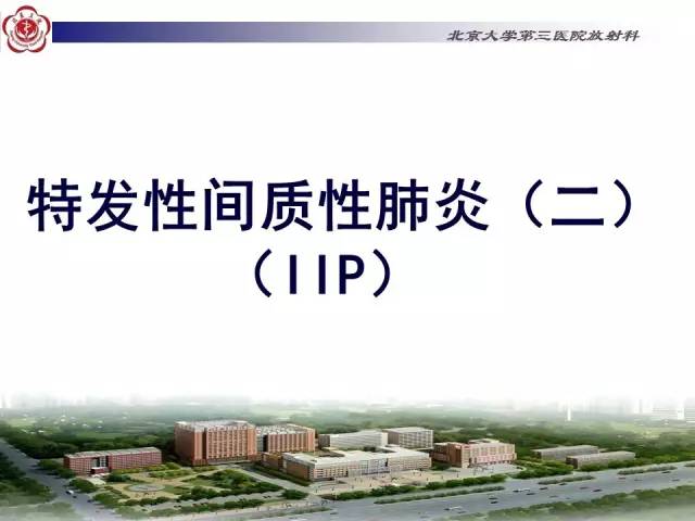 【病例】特发性间质性肺炎2例CT影像表现