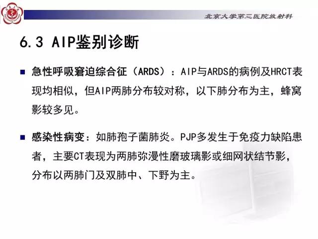 【病例】特发性间质性肺炎2例CT影像表现