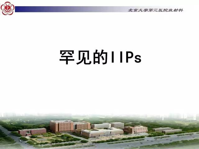 【病例】特发性间质性肺炎2例CT影像表现