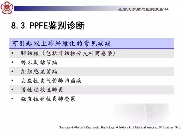 【病例】特发性间质性肺炎2例CT影像表现