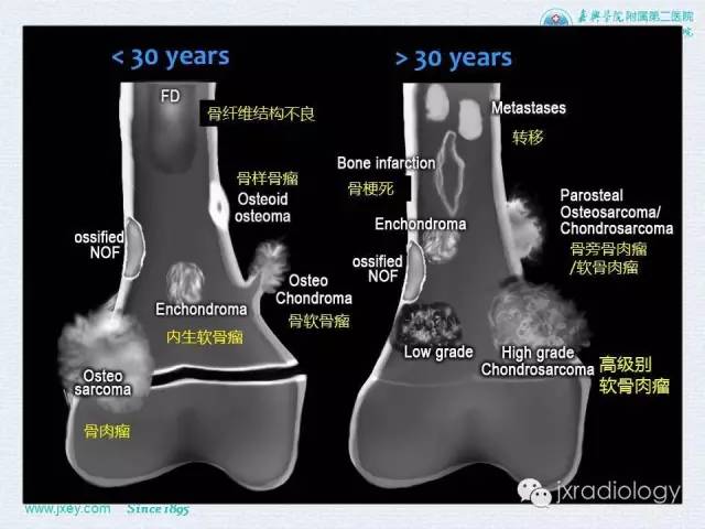 【PPT】膝关节骨肿瘤及肿瘤样病变的MR诊断