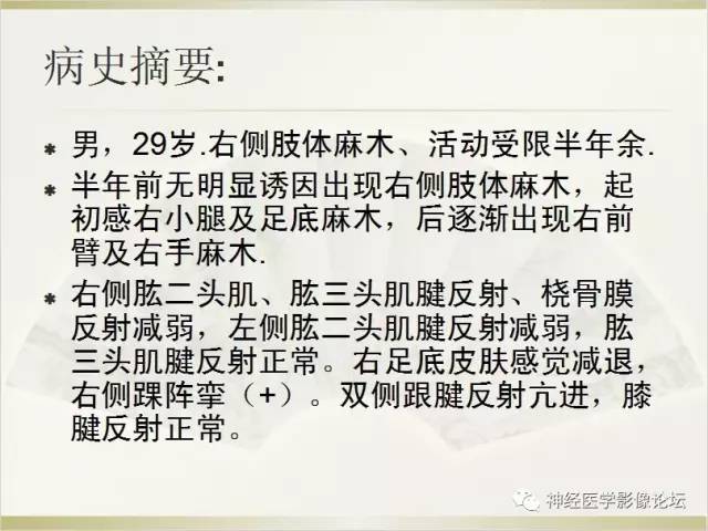 【病例】脊髓室管膜瘤1例MR影像表现 【病例】脊髓室管膜瘤1例MR影像表现