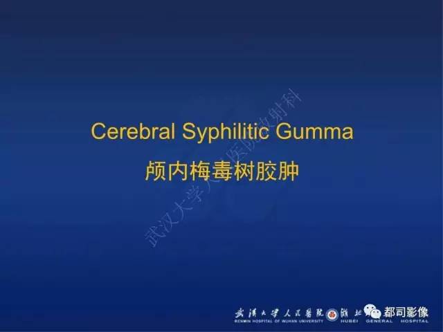 【PPT】颅内梅毒树胶肿影像诊断