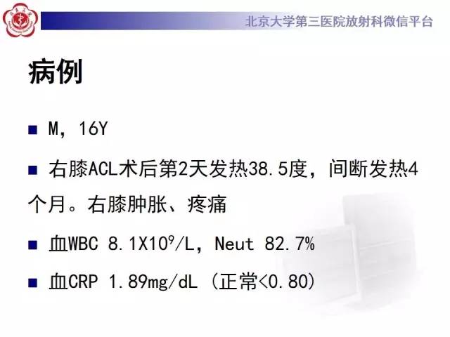 【病例】膝关节术后化脓性关节炎1例X线MR影像表现