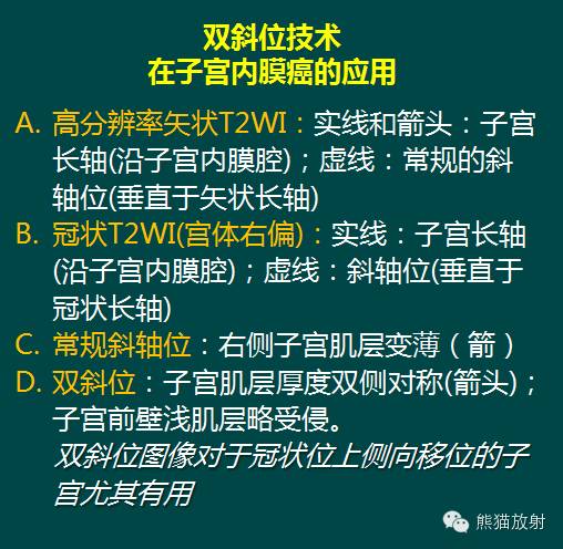 【PPT】子宫内膜癌及宫颈癌的MR扫描及评估【RG精选】 【PPT】子宫内膜癌及宫颈癌的MR扫描及评估【RG精选】